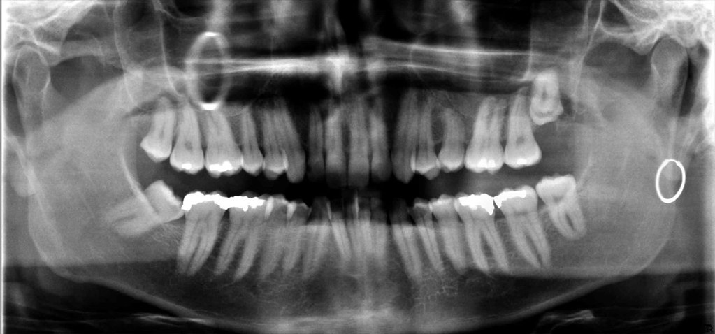 Dentista que triplicou intervenções em paciente terá de ressarci-la por sofrimento